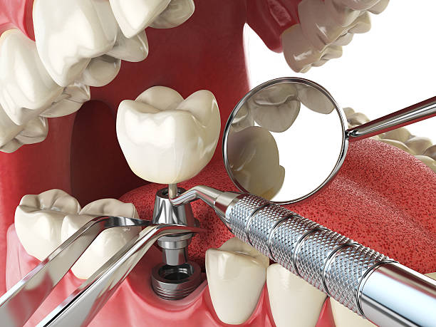 Reliable WY Emergency Dental Service Solutions